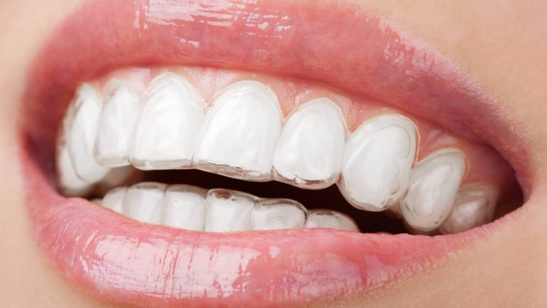 Come sono fatti i denti?