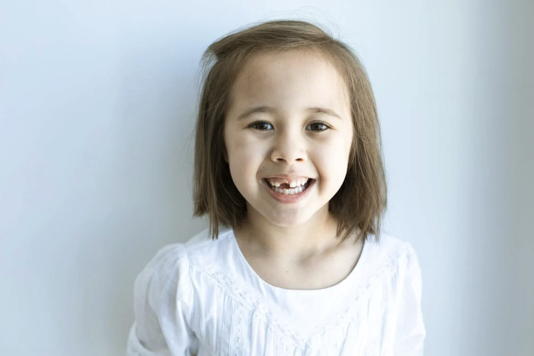 Decifrare lo Scopo dei Denti da Latte nello Sviluppo del Tuo Bambino